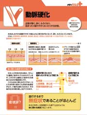 メディカルテ　動脈硬化